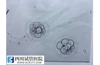做試管嬰兒一次移植多個(gè)襄胚有好處嗎？